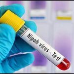 nipah virus