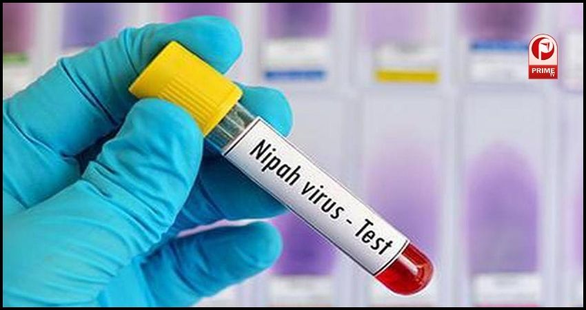 nipah virus