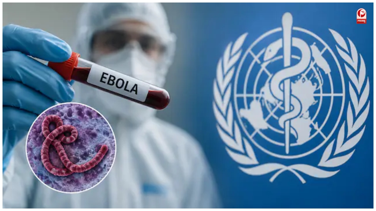 Ebola Virus