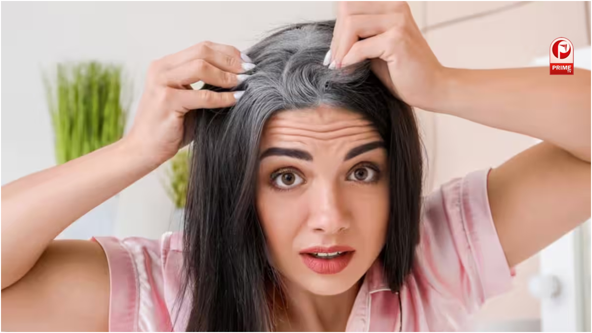 Premature Grey Hair