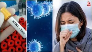 UP Swine Flu